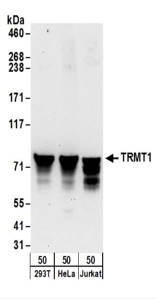 TRMT1 Antibody (aa25-75)