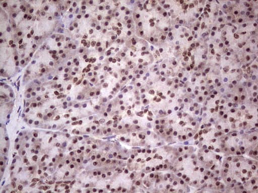 LPIN1 / Lipin 1 Antibody (aa1-274, clone OTI2H6)
