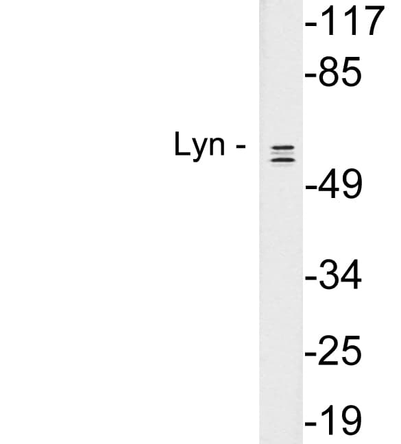 Polyclonal Rabbit anti-Human LYN Antibody (aa459-508, WB)