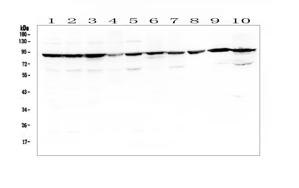 SLC6A4 / SERT Antibody (aa57-85)