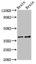 Polyclonal Rabbit anti-Human GNB1 Antibody (IF, WB)