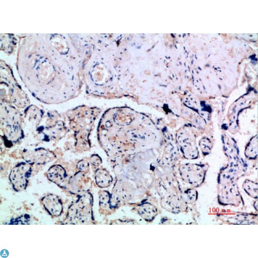 INHA / Inhibin Alpha Antibody
