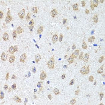 Polyclonal Rabbit anti-Human IL8 / Interleukin 8 Antibody (IHC)