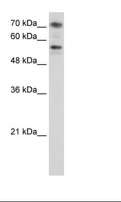 Polyclonal Rabbit anti-Human BRD7 Antibody (C-Terminus, IHC, WB)