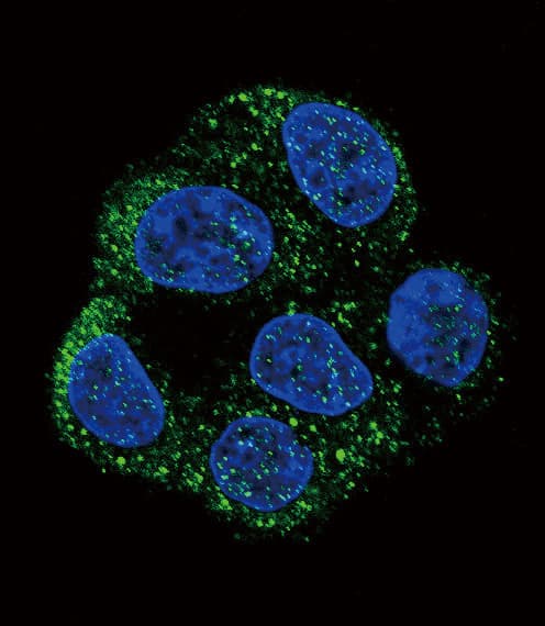 Polyclonal Rabbit anti-Human NOS3 / eNOS Antibody (aa48-75, IHC, IF, WB)