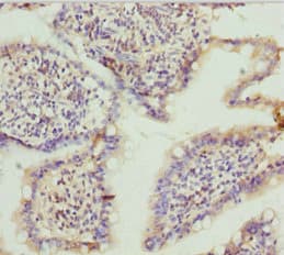 TNS3 / Tensin 3 Antibody