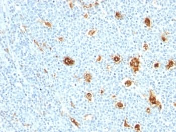 S100A9 / MRP14 Antibody (clone MRP14/840)