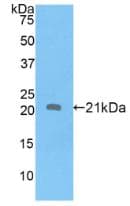 APOD / Apolipoprotein D Antibody (aa21-189)