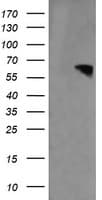 RTKN / Rhotekin Antibody (clone OTI2E9)
