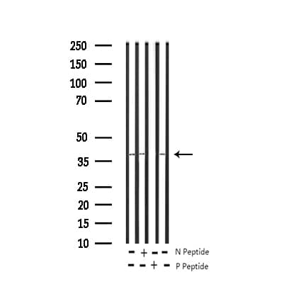 JUN / c-Jun Antibody (phospho-Ser73)