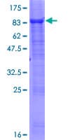 Human SESN2 / HI95 Protein (Recombinant GST)