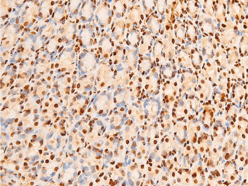 JUN / c-Jun Antibody (phospho-Ser243)