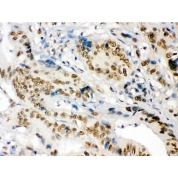 NONO / P54NRB Antibody (aa1-35)