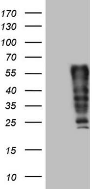 Monoclonal Mouse anti-Human FOS / c-FOS Antibody (clone OTI4H1, WB)