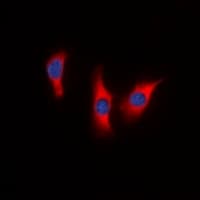 DUSP9 Antibody (Internal)