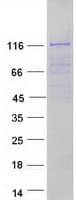 Human FMNL3 Protein (Recombinant Myc-DDK (Flag))