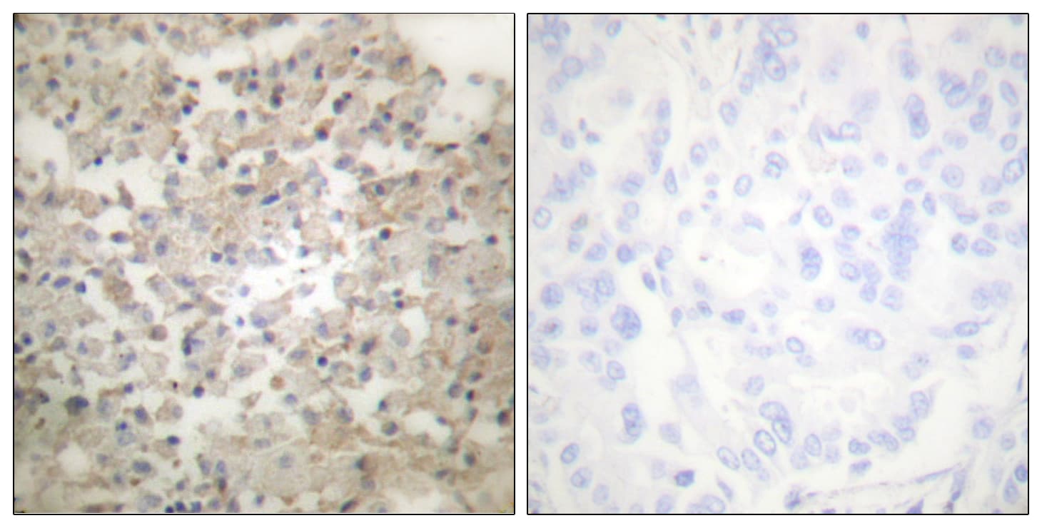 TPH1 / Tryptophan Hydroxylase Antibody (phospho-Ser260)