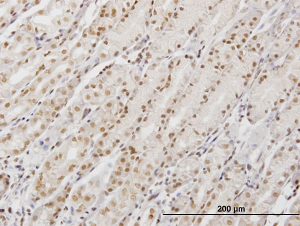 Monoclonal Mouse anti-Human DP97 / DDX54 Antibody (clone 2E4, IHC, WB)