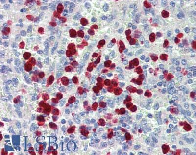 IHC-plus™ Polyclonal Rabbit anti-Human S100A12 Antibody (IHC, WB)