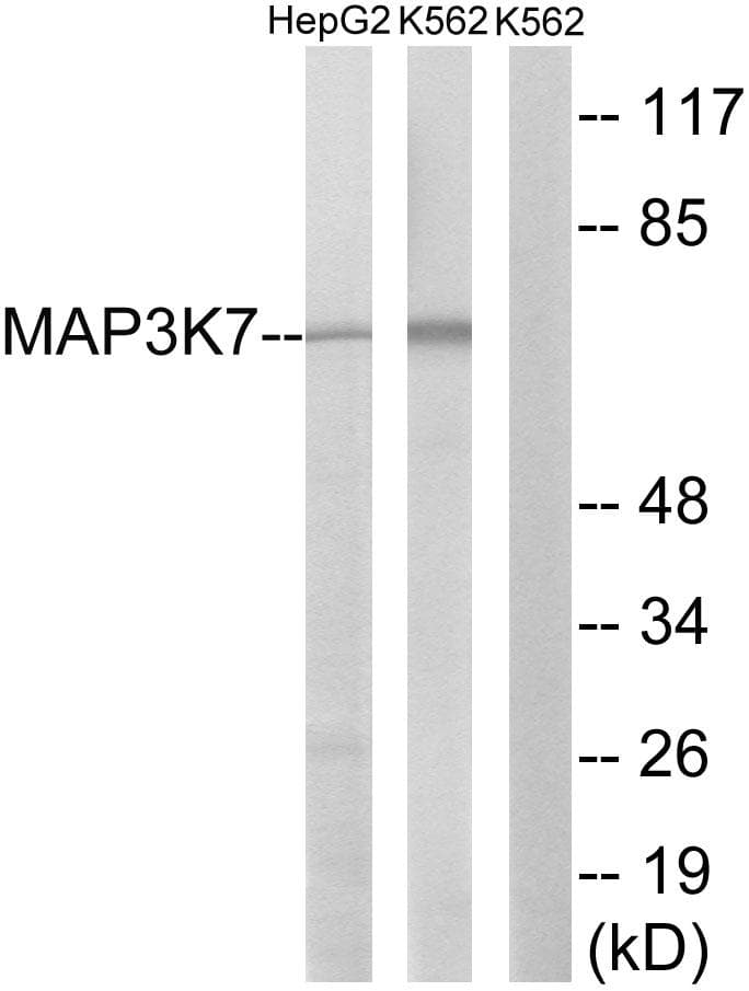 MAP3K7 / TAK1 Antibody (p439)