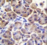 Polyclonal Rabbit anti-Human MRPS12 / RPSM12 Antibody (aa28-59, IHC, WB)