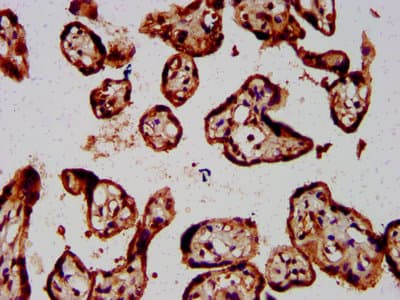FOLR1 / Folate Receptor Alpha Antibody