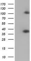 ZFP36 / Tristetraprolin Antibody (clone OTI1G9, Carrier-free)