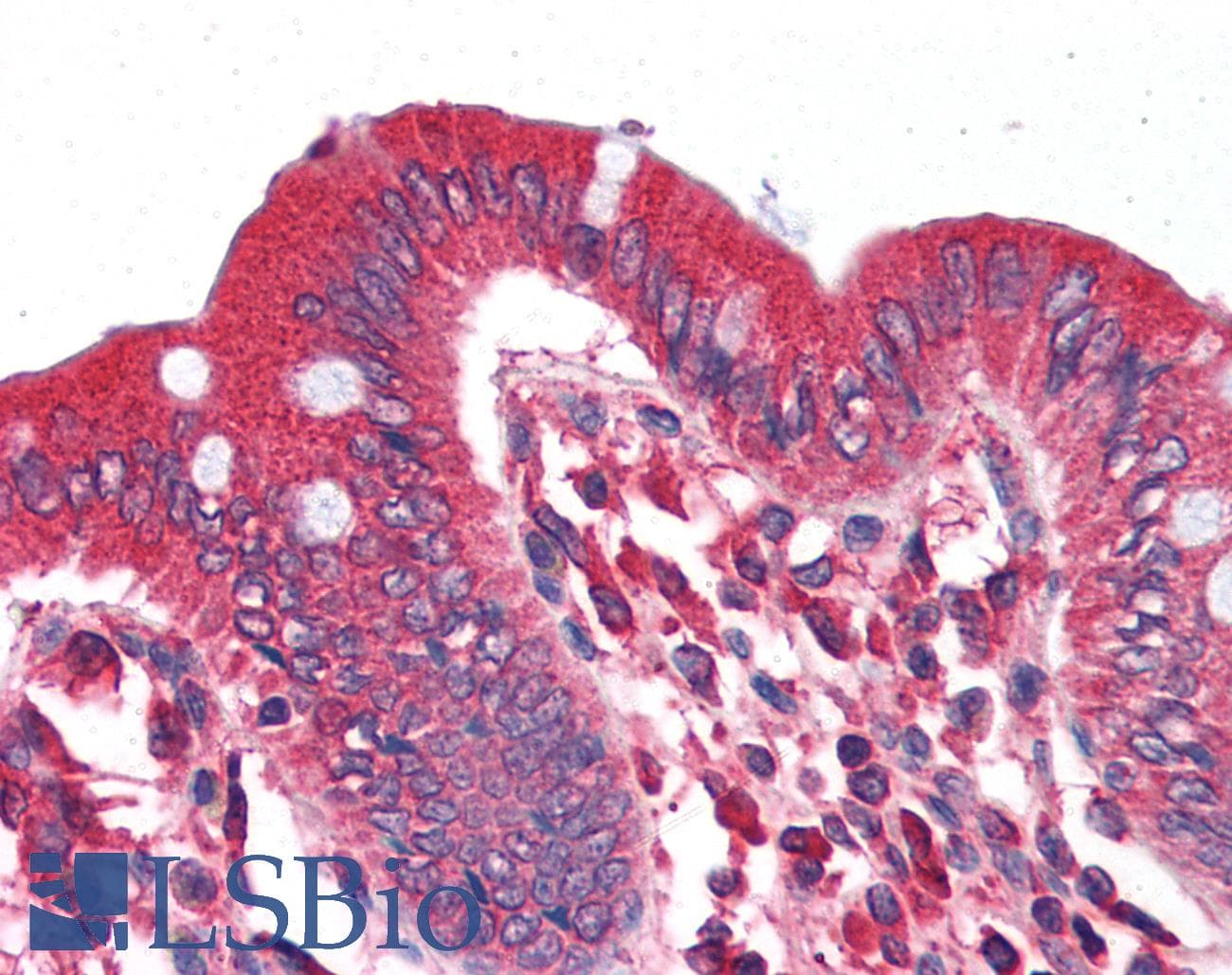 IHC-plus™ SLC5A1 / SGLT1 Antibody