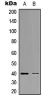 ZNF134 Antibody (Internal)