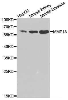 Polyclonal Rabbit anti-Human MMP13 Antibody (WB)