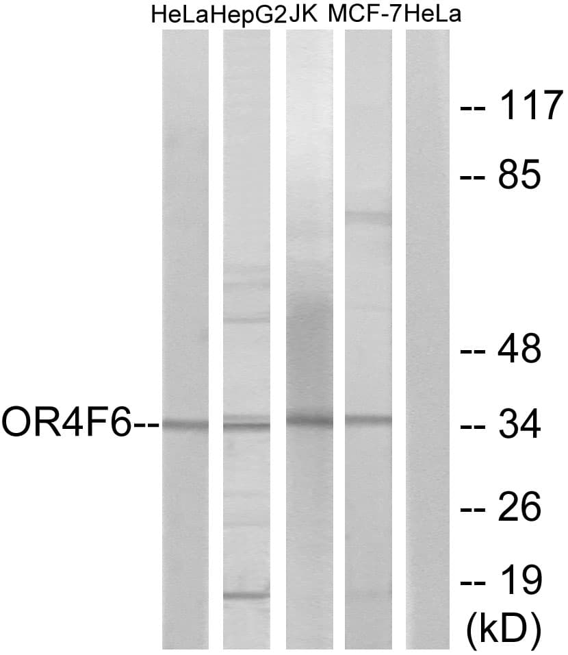 Polyclonal Rabbit anti-Human OR4F6 Antibody (aa55-104, IF, WB)