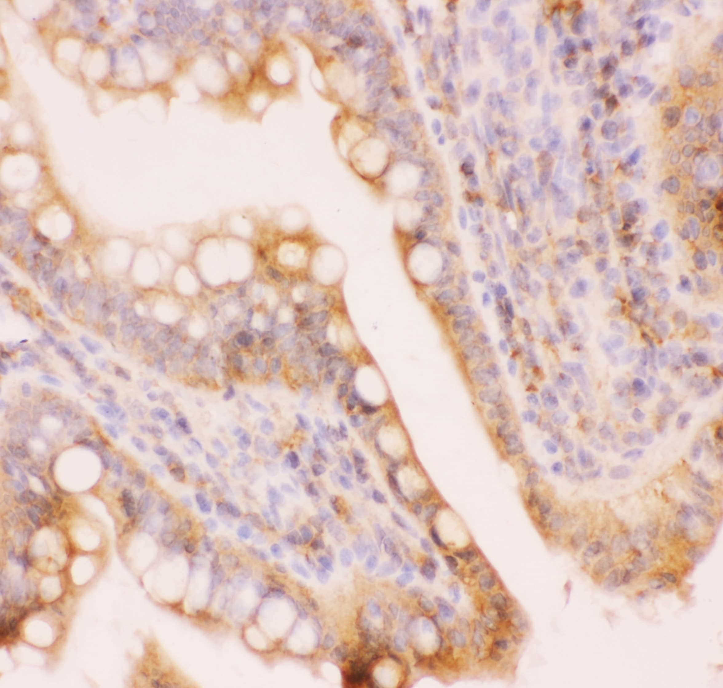 ABCC4 / MRP4 Antibody (aa1-370)