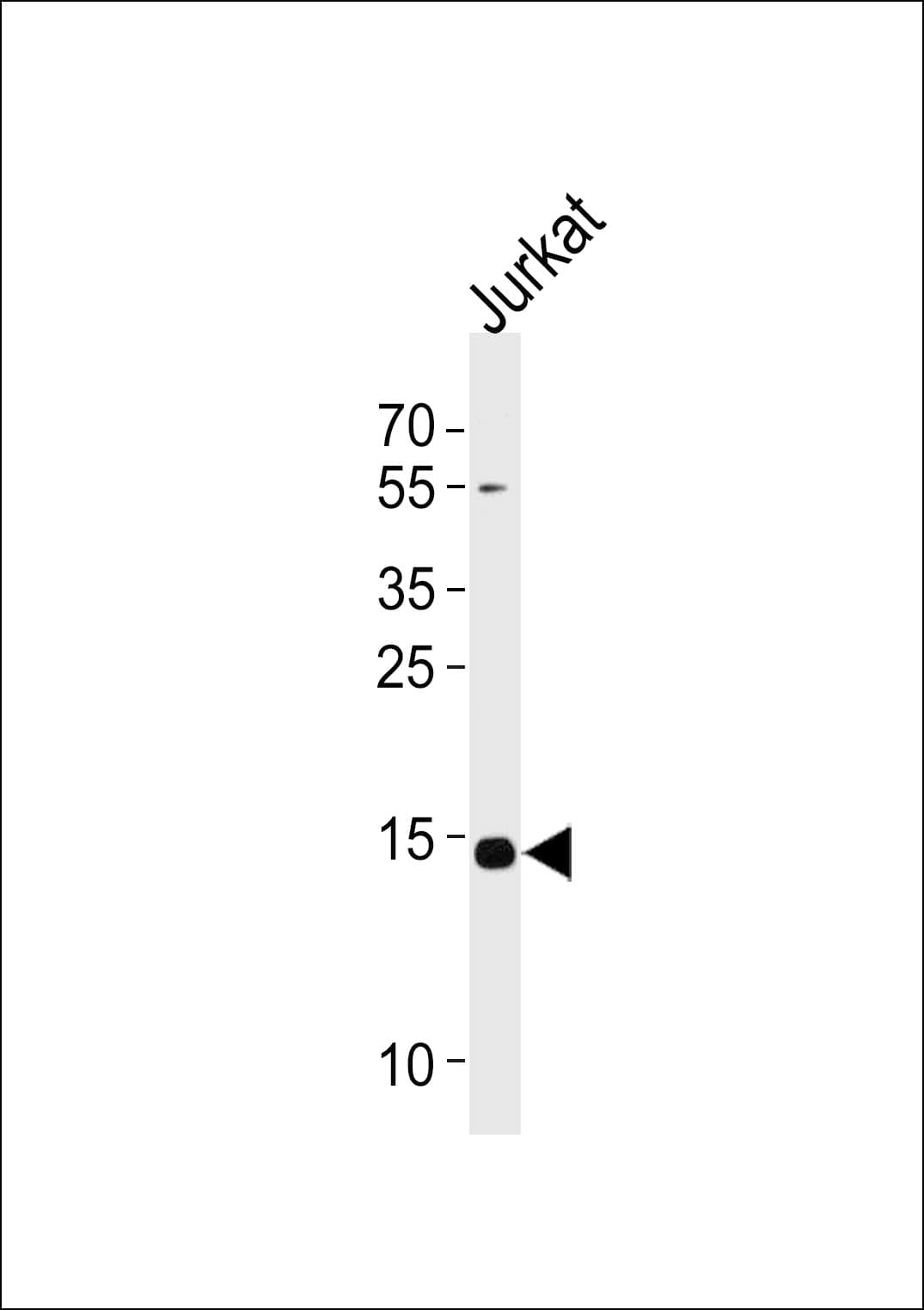 Polyclonal Rabbit anti-Human UBE2D4 Antibody (aa111-140, WB)