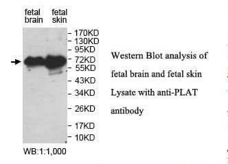 Polyclonal Rabbit anti-Human PLAT / TPA Antibody (aa87-377, IHC, WB)