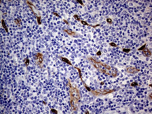 NES / Nestin Antibody (aa99-349, clone OTI1B4, Carrier-free)