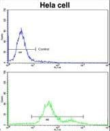 Polyclonal Rabbit anti-Human MCAM / CD146 Antibody (aa161-189, IHC, WB)
