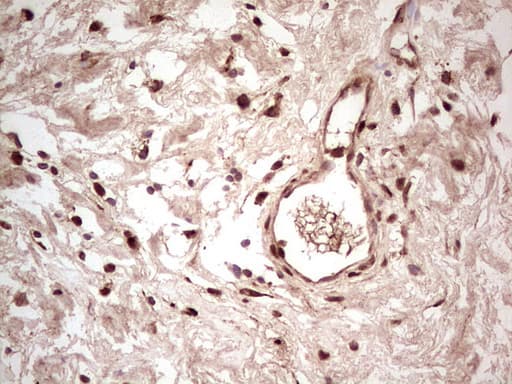 Monoclonal Mouse anti-Human NR3C1/Glucocorticoid Receptor Antibody (clone OTI7A3, aa1-265, IHC, WB)