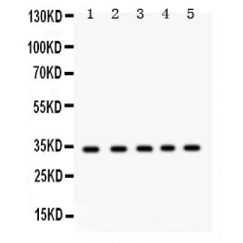 EBAG9 / RCAS1 Antibody (aa31-213)