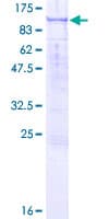Human RASAL1 / RASAL Protein (Recombinant GST)