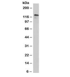 CDH3 / P-Cadherin Antibody (clone 12H6)