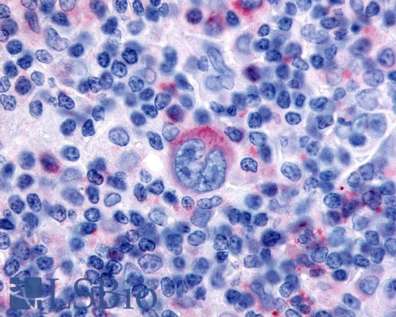 PathPlus™ Polyclonal Rabbit anti-Human GPR65 / TDAG8 Antibody (Cytoplasmic Domain, IHC)