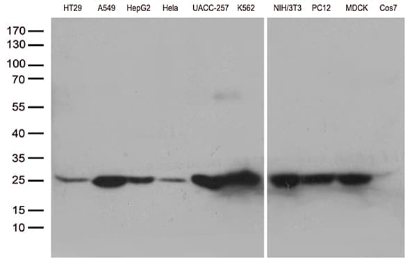 Monoclonal Mouse anti-Human SDHB Antibody (clone OTI3F5, IHC, WB)