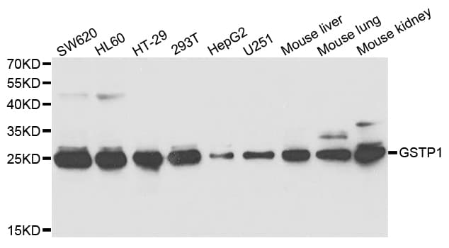 Polyclonal Rabbit anti-Human GSTP1 / GST Pi Antibody (IHC, IF, WB)