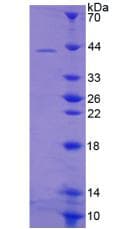 Human DEFA1B / Defensin Alpha 1B Protein (Recombinant His-GST)