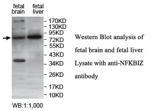 Polyclonal Rabbit anti-Human NFKBIZ / IKBZ Antibody (C-Terminus, WB)