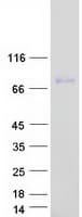Human IGFALS / ALS Protein (Recombinant Myc-DDK (Flag))
