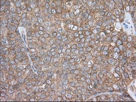 Monoclonal Mouse anti-Human PDE4A / PDE4 Antibody (clone OTI2G2, IHC, IF, WB)