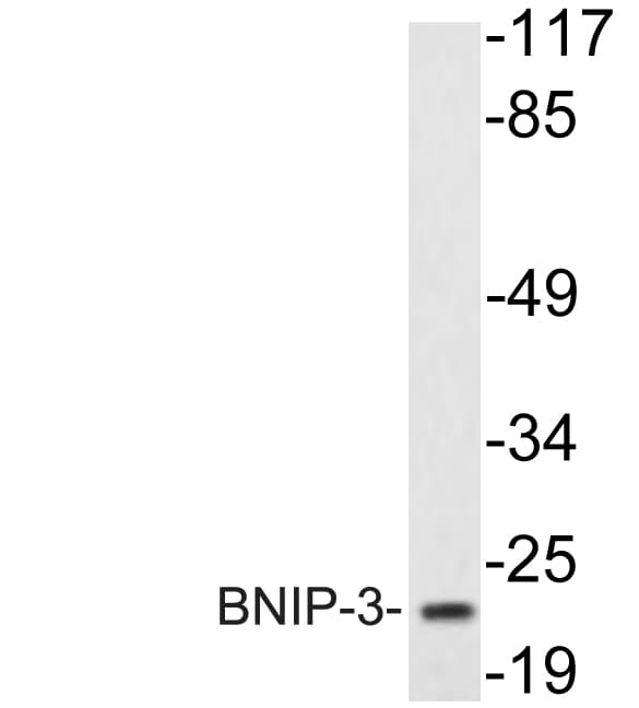 IHC-plus™ NIP3 / BNIP3 Antibody (aa47-96)