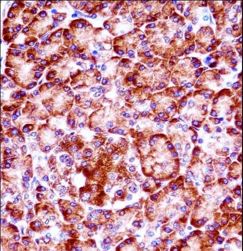 Polyclonal Rabbit anti-Human RIPK3 / RIP3 Antibody (aa480-509, IHC, WB)