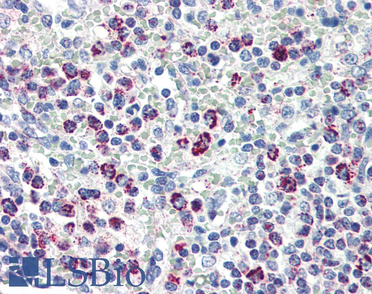 PathPlus™ Monoclonal Mouse anti-Human HSPD1 / HSP60 Antibody (clone LK1, IHC, WB)